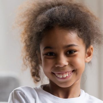 Treating Malocclusion for a Healthier Smile
