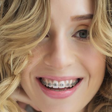 Different Orthodontic Treatments : A Detailed Look