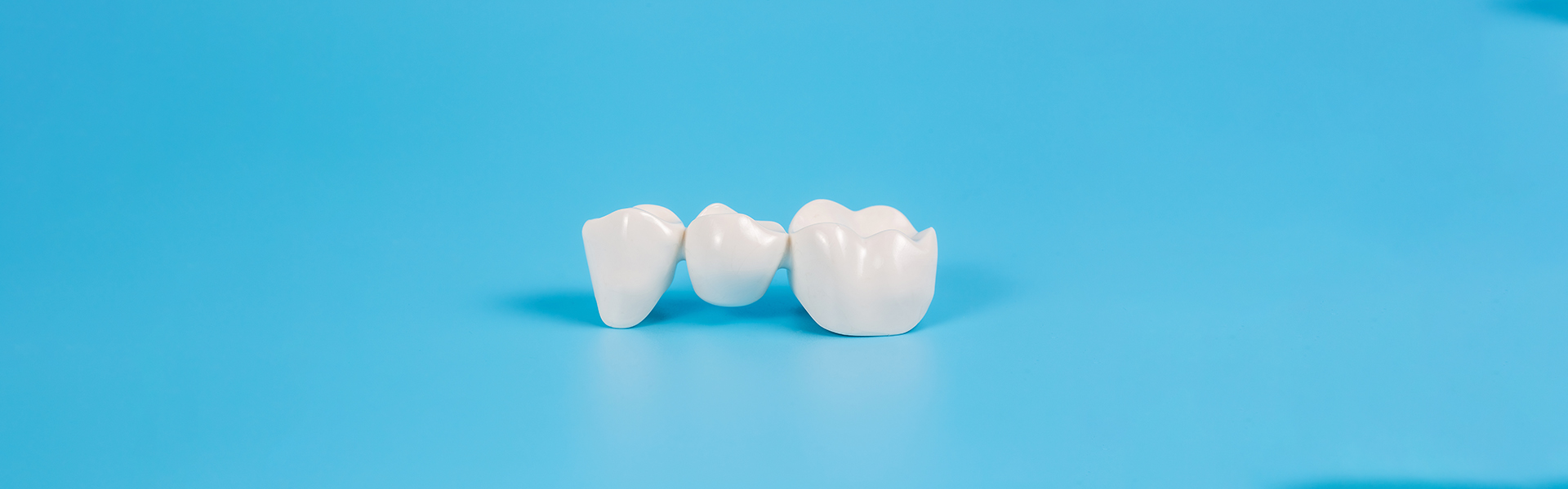 6 Oral Issues That Veneers Can Resolve