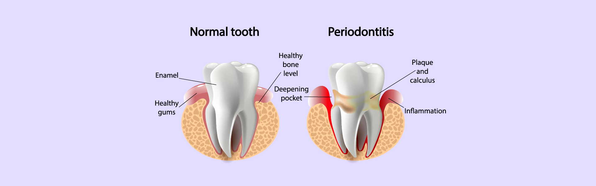 Unveiling the Secrets of Periodontics: Your Comprehensive Guide to Gum Health, Treatment, and Prevention Strategies